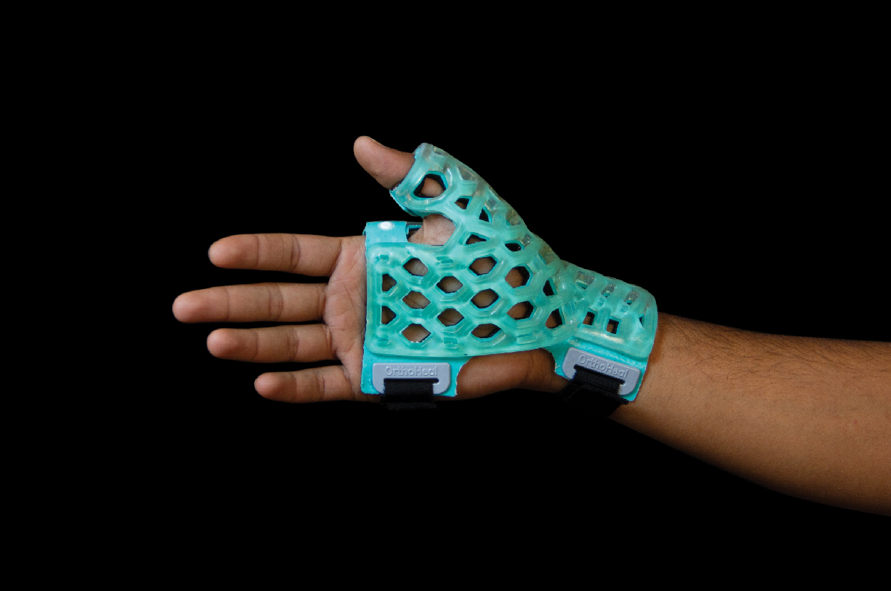 Flexicast-Thumb Spica Immobilizer