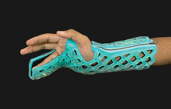 Flexicast-Ulnar-Gutter-immobilizer